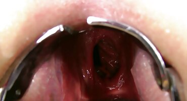 ພັດທະນາເປັນ slut asshole.