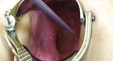 Silicone depraved ຜິວເນື້ອສີຂາວ fucks ກັບຜູ້ຜະລິດທີ່ມັກ Negritos.